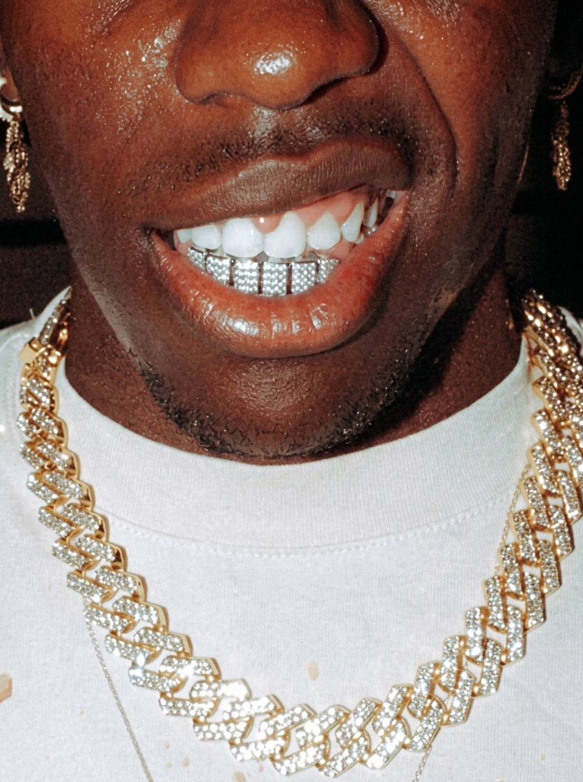 L'Impero del Sorriso: Storia, Origini e l'Impatto Culturale dei Grillz nell'Hip-Hop